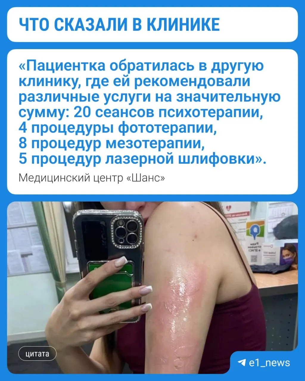 В клинике заявили, что женщине стало плохо, она легла на кушетку и соприкоснулась с батареей. Медики описали оказанную помощь, извинились и предложили бесплатные услуги, но пациентка отказалась.