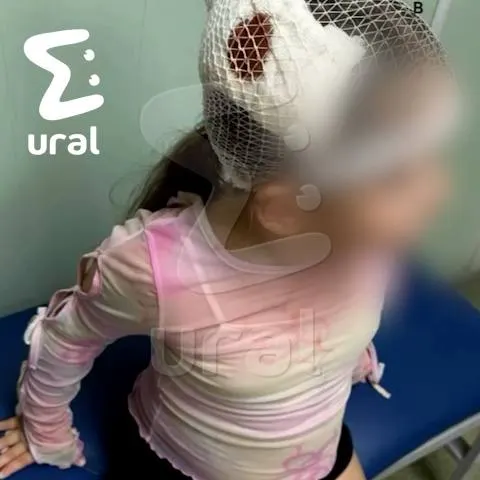 В квартире ребёнка придавило шкафом: мать подняла мебель и вызвала скорую, в больнице диагностировали переломы позвоночника в четырёх местах.