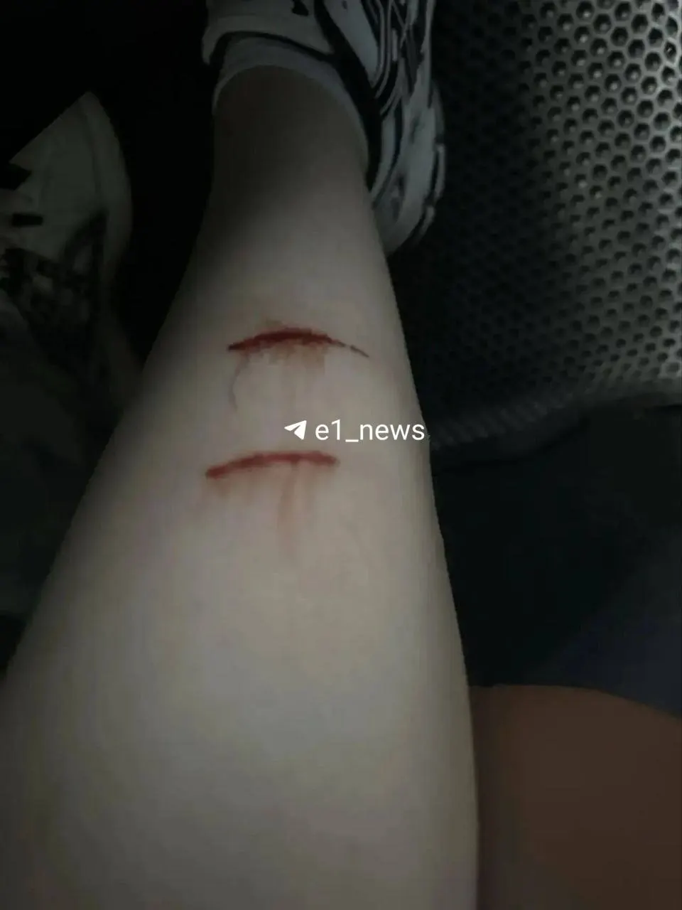 16-летняя девушка пострадала после нападения бродячих собак на улице Европейской в Екатеринбурге. Прохожий помог пострадавшей добраться до больницы, затем последовало медицинское обследование.
